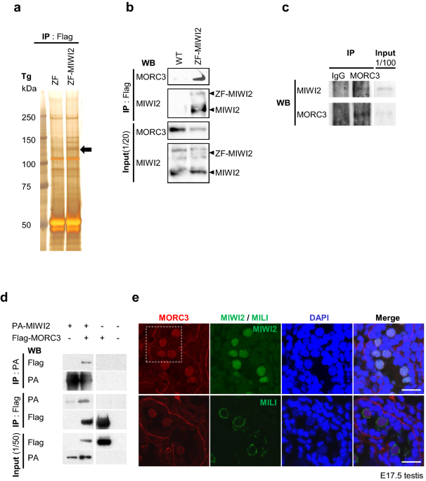 MORC3, a novel MIWI2 association partner, as an epigenetic regulator of piRNA dependent transposon silencing in male germ cells – Nature