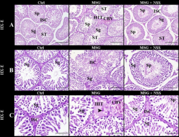 Antioxidant and cytoprotective effects of Nigella sativa L. seeds on the testis of monosodium glutamate challenged rats – Nature
