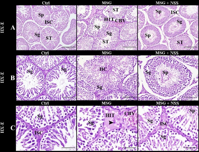 Antioxidant and cytoprotective effects of Nigella sativa L. seeds on the testis of monosodium glutamate challenged rats – Nature