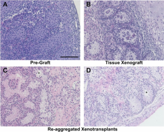 Reconstitution of rat fetal testis during the masculinisation programming window induces focal dysgenesis consistent with testicular dysgenesis syndrome | Scientific Reports – Nature