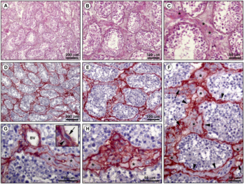 Reappraising the microscopic anatomy of human testis: identification of telocyte networks in the peritubular and intertubular stromal space – Nature